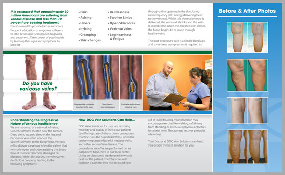 DOC Vein Solutions Brochure Inside